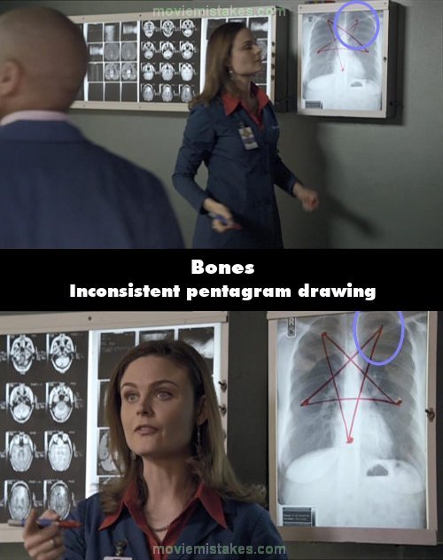 Bones picture