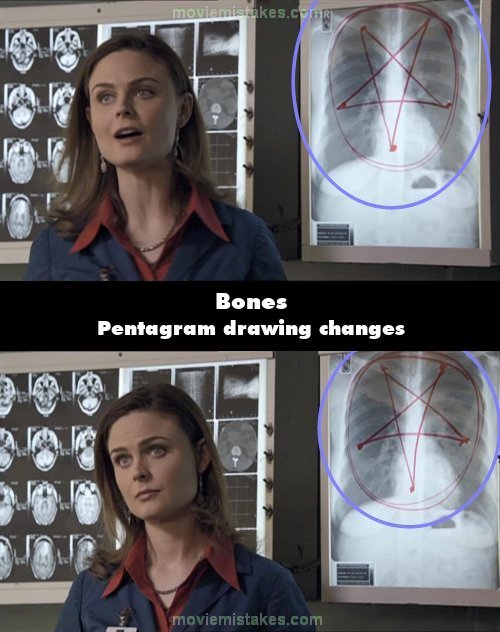 Bones picture