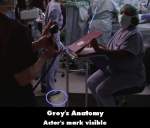 Grey's Anatomy mistake picture