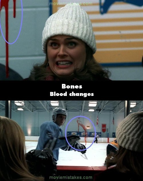 Bones picture