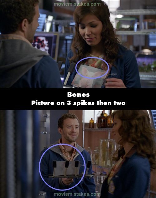 Bones picture