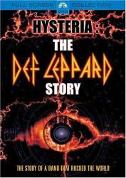 Hysteria: The Def Leppard Story picture